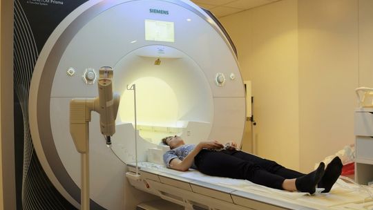 Badacze znaleźli specyficzne zmiany w mózgach pacjentów po przebytym COVID-19