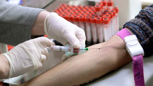 Badania: co piąta osoba z HIV nie wie o swoim zakażeniu, co szósta z pozytywnym wynikiem - nie podejmuje leczenia