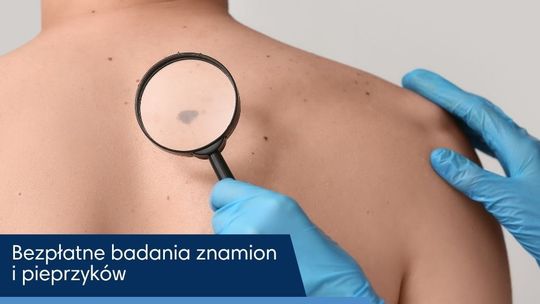 Bezpłatne badania znamion dla mieszkańców subregionu. Affidea NU-MED rusza z programem