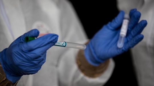 CDC: przeziębienia, grypa, Covid-19 i wirus RSV powodują podobne objawy, bez testów trudno je odróżnić