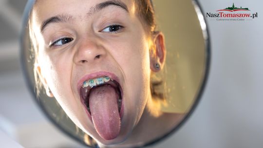Co mówi Twój język o stanie zdrowia jamy ustnej?
