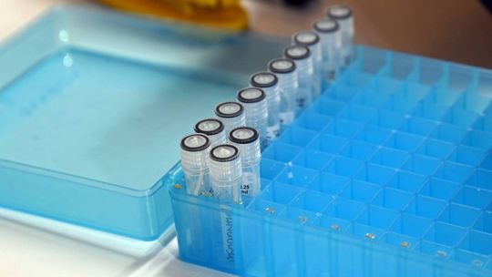 Dr Sutkowski: zakażeń COVID-19 jest o wiele więcej niż pokazują statystyki
