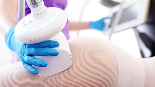 Endermologia, czyli skuteczna broń w walce z cellulitem