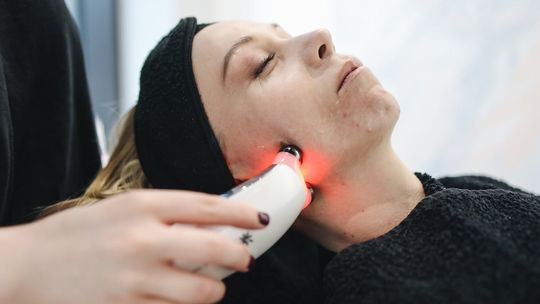 Jak działa laser do depilacji?