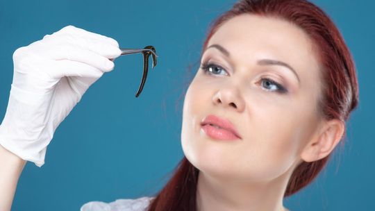 Jak hirudoterapia może pomóc na podwyższony cholesterol?