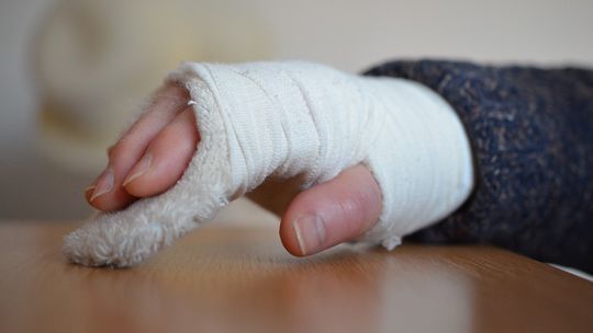 Jak uzyskać odszkodowanie za złamanie na skutek wypadku?