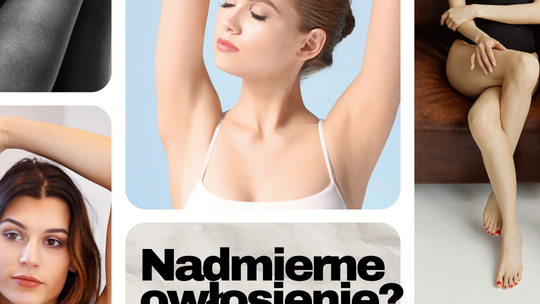 Który laser do depilacji wybrać?