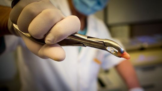 Leczenie zębów w Tomaszowie bywa dwukrotnie droższe. Pacjenci wnoszą opłaty "koronawirusowe"