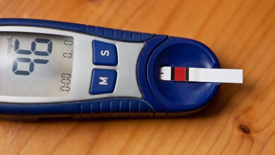 Narodowy Fundusz Zdrowia: blisko milion Polaków może być nieświadomych, że choruje na cukrzycę