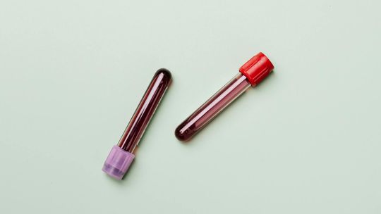 Neutrofile w badaniach krwi – co może wpływać na ich poziom?