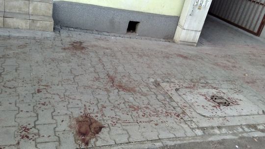 Niebezpieczne petardy. Smutny finał Sylwestrowej Nocy