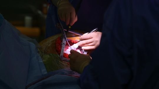 Ogólnopolski dzień transplantacji: każdy jest potencjalnym dawcą narządów