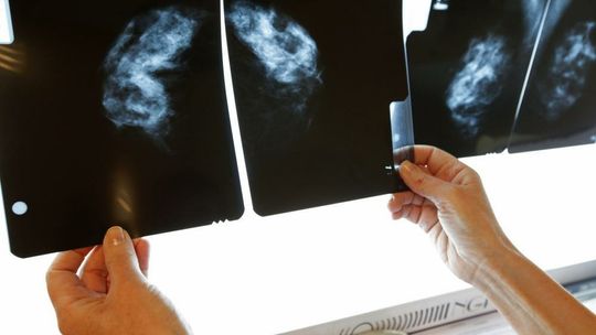Onkolog: pandemia zaciągnęła w onkologii dług zdrowotny, z którym długo będziemy się borykać