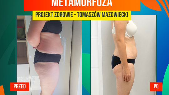 „Poszłam po pomoc w redukcji wagi,  a zyskałam o wiele więcej”