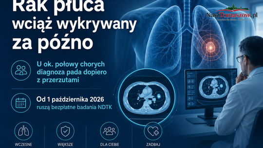 Rak płuca wciąż wykrywany za późno. U połowy chorych są już przerzuty