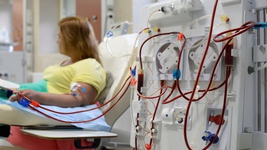 Światowy Dzień Nerek 2022 – 4 mln Polaków cierpią na przewlekłą chorobę nerek