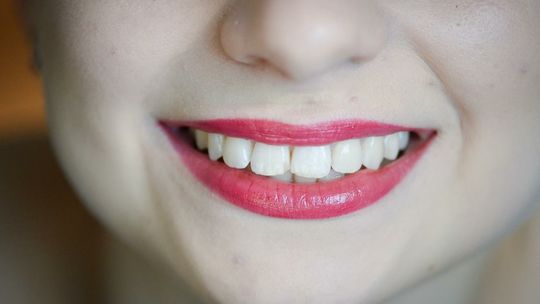 UOKiK: prawie 3,5 mln zł kary dla Dr Smile za sposób zawierania umów z konsumentami
