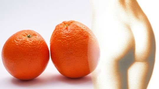 Z pomarańczową skórką można sobie poradzić