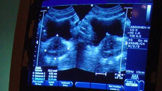 Zaproszenie na bezpłatną spirometrię