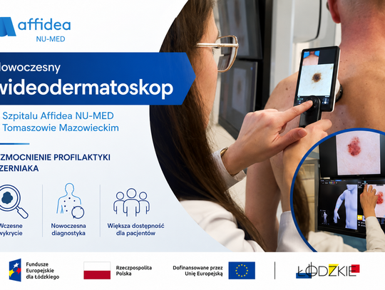 Affidea NU-MED w Tomaszowie Mazowieckim z nowym wideodermatoskopem. Szybsza diagnostyka czerniaka i zmian skórnych