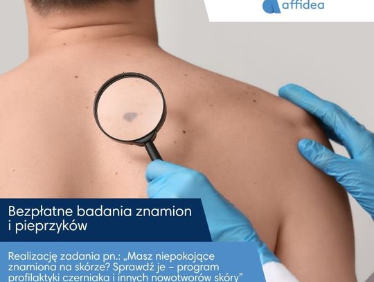 Bezpłatne badania znamion dla mieszkańców subregionu. Affidea NU-MED rusza z programem