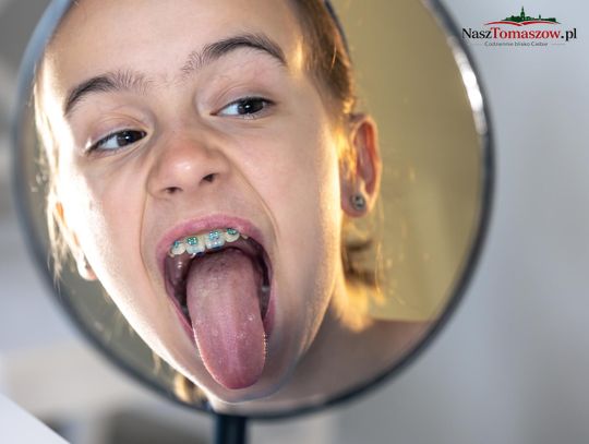 Co mówi Twój język o stanie zdrowia jamy ustnej?