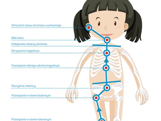 Koślawość u dzieci - jak sobie z nią radzić?