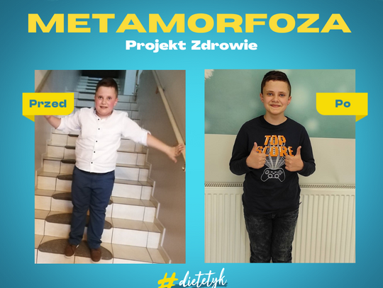 Maksymilian - wyjątkowy chłopiec – wyjątkowe 10 kg mniej !