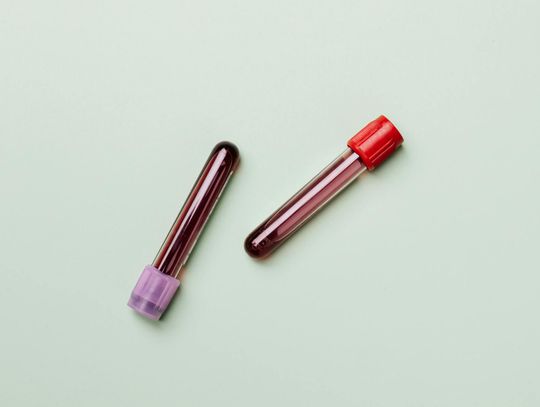 Neutrofile w badaniach krwi – co może wpływać na ich poziom?