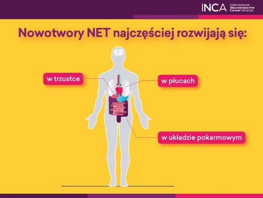 NOWOTWORY NEUROENDOKRYNNE –  INNE NIŻ WSZYSTKIE