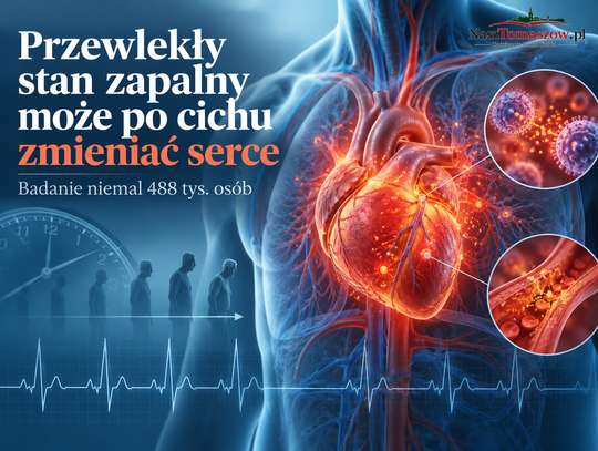 Przewlekły stan zapalny może latami zmieniać serce. Badanie niemal pół miliona osób