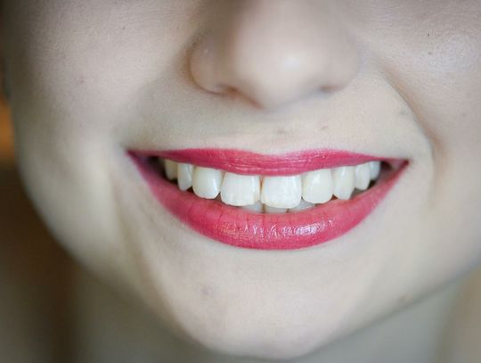 UOKiK: prawie 3,5 mln zł kary dla Dr Smile za sposób zawierania umów z konsumentami