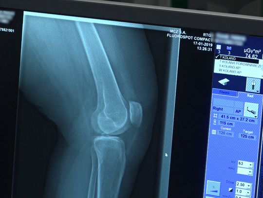 W wyniku pandemii tysiące chorych na osteoporozę pozostają bez pomocy. Lekarze i pacjenci apelują o proste zmiany umożliwiające diagnostykę i leczenie