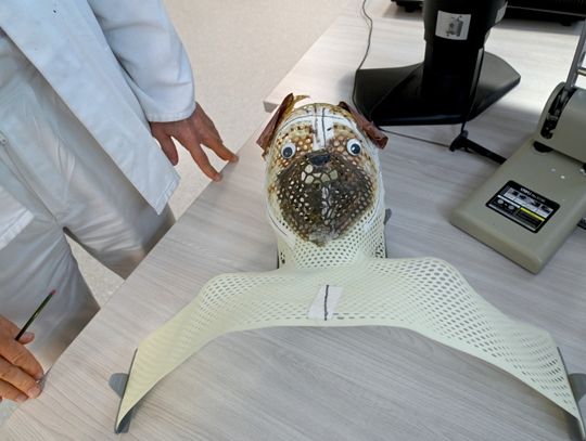 Z powodu późnego wykrycia raka głowy i szyi dwie trzecie chorych nie przeżywa 5 lat