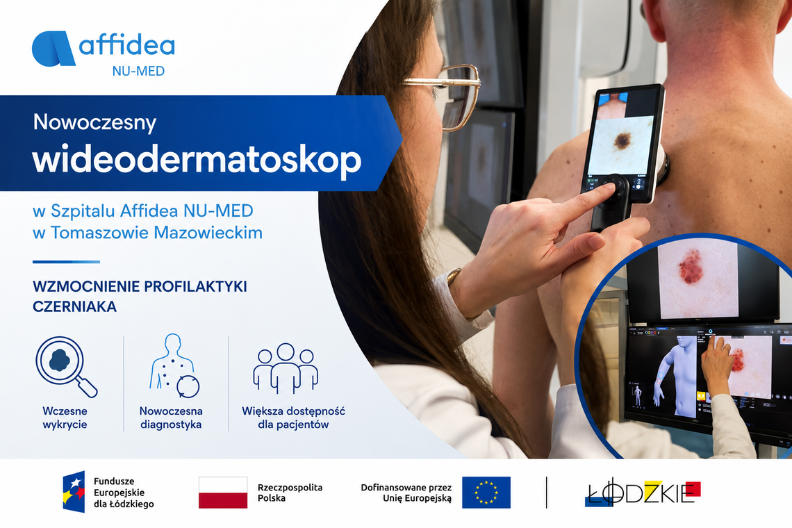 Affidea NU-MED w Tomaszowie Mazowieckim z nowym wideodermatoskopem. Szybsza diagnostyka czerniaka i zmian skórnych