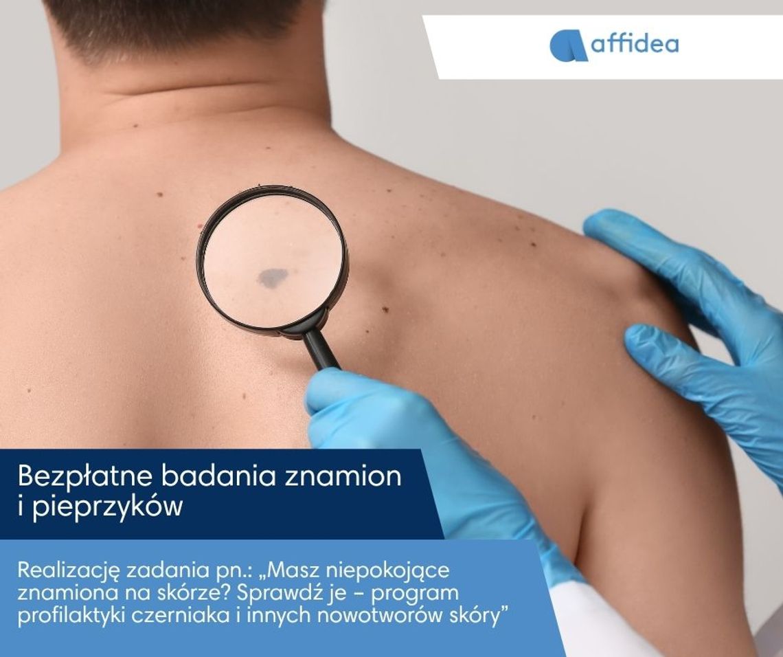 Bezpłatne badania znamion dla mieszkańców subregionu. Affidea NU-MED rusza z programem