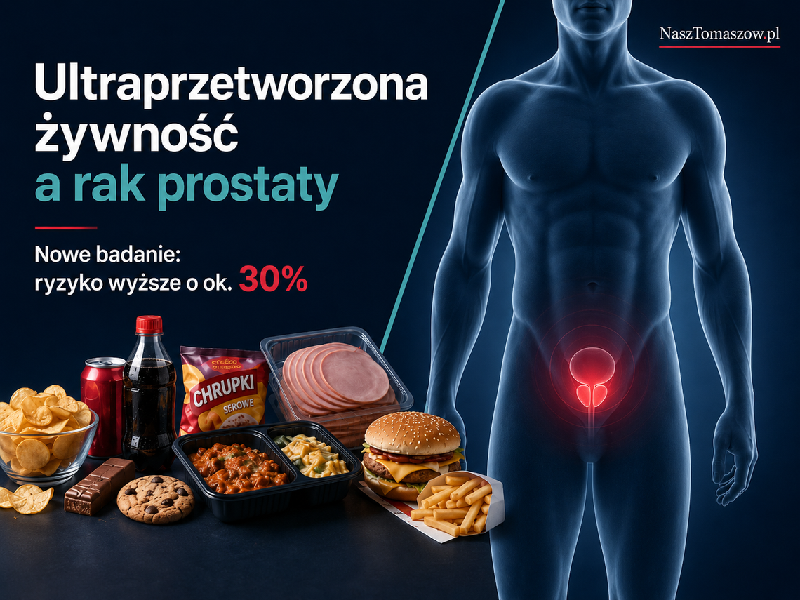 Co drugi kęs z fabryki? Naukowcy łączą ultraprzetworzoną żywność z wyższym ryzykiem raka prostaty