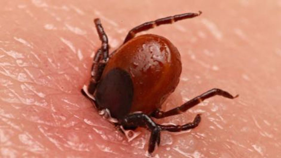 Ekspert: wystarczy usunąć kleszcza w ciągu 24 godzin, żeby uniknąć zakażenia Ekspert: wystarczy usunąć kleszcza w ciągu 24 godzin, żeby uniknąć zakażenia