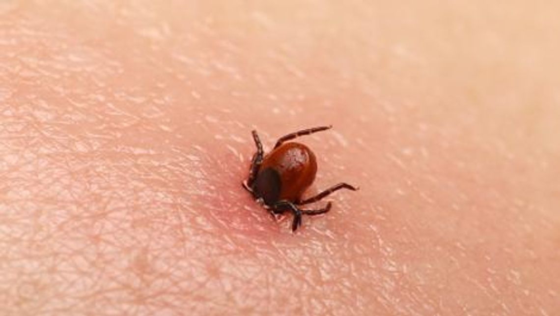 Kwestia kleszczy jest często wyolbrzymiana i staje się problemem psychologicznym Kwestia kleszczy jest często wyolbrzymiana i staje się problemem psychologicznym