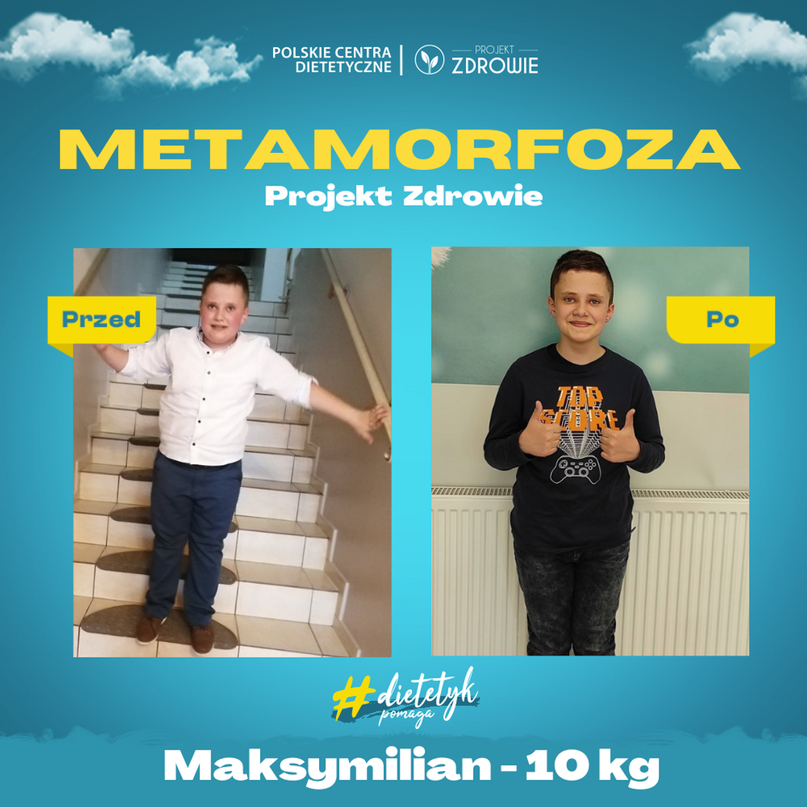 Maksymilian - wyjątkowy chłopiec – wyjątkowe 10 kg mniej !
