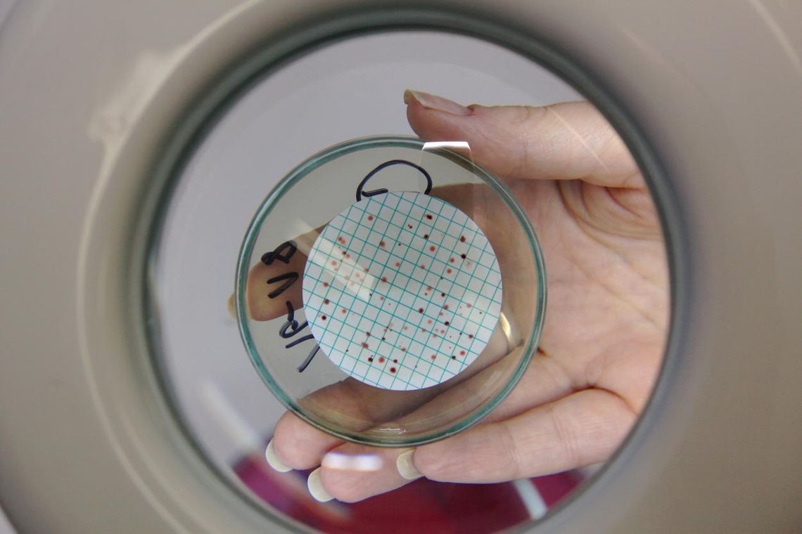 Prof. Hryniewicz: proces uodparniania się drobnoustrojów na antybiotyki przyspiesza