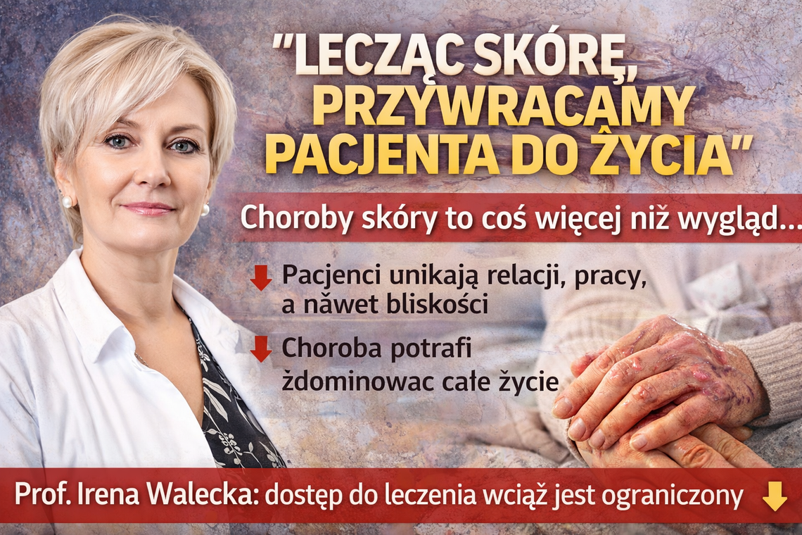 Prof. Walecka: lecząc skórę, przywracamy pacjenta do życia społecznego (wywiad)