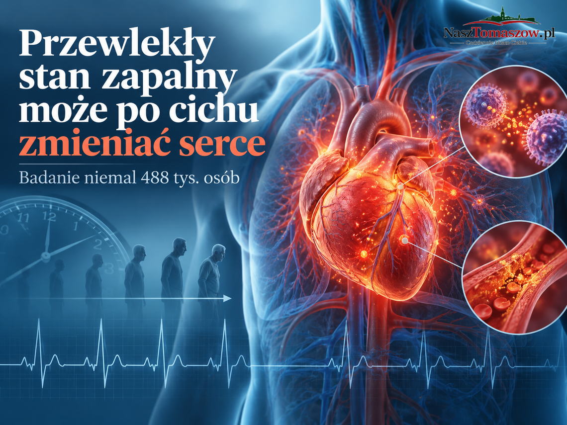 Przewlekły stan zapalny może latami zmieniać serce. Badanie niemal pół miliona osób Przewlekły stan zapalny może latami zmieniać serce. Badanie niemal pół miliona osób