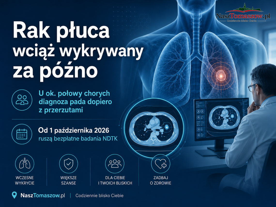 Rak płuca wciąż wykrywany za późno. U połowy chorych są już przerzuty