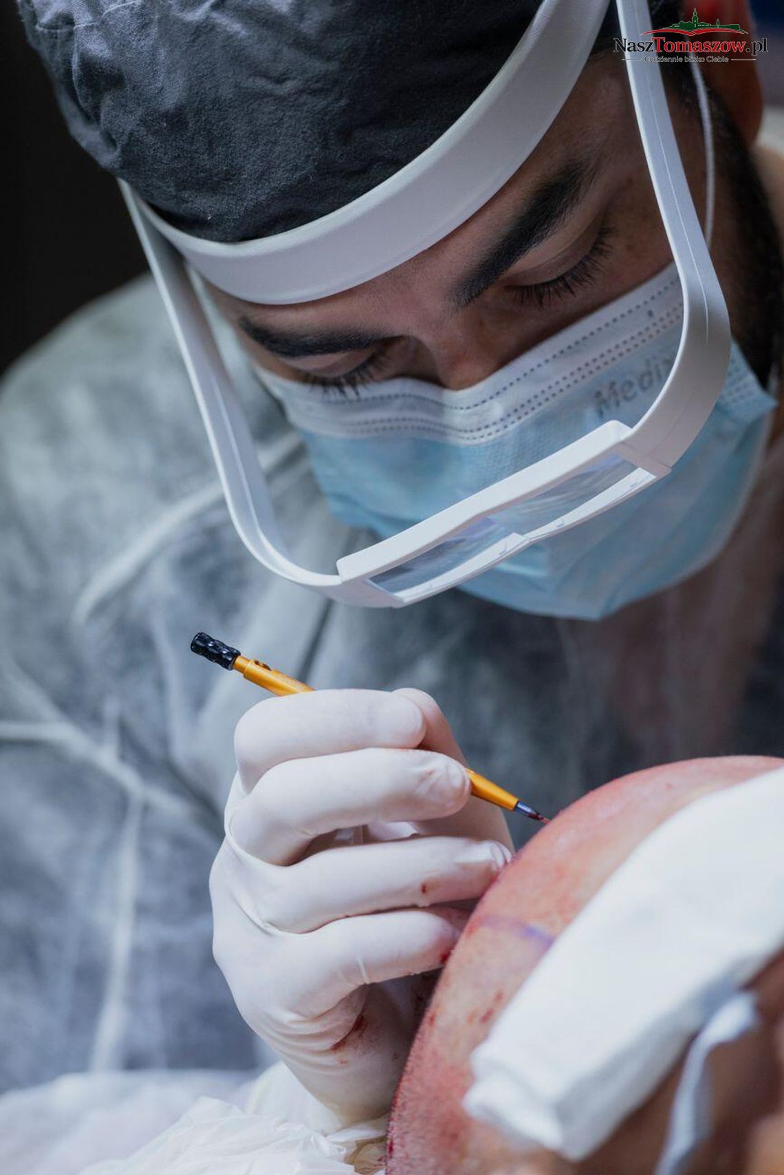 Rola neurochirurga w diagnozowaniu i leczeniu schorzeń obwodowego układu nerwowego oraz kręgosłupa Rola neurochirurga w diagnozowaniu i leczeniu schorzeń obwodowego układu nerwowego oraz kręgosłupa