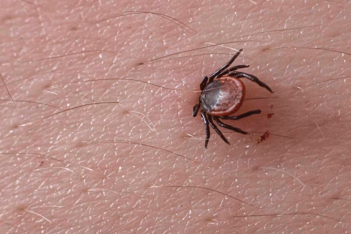 W tym roku potwierdzono w Polsce 7686 przypadków boreliozy i 147 kleszczowego zapalenia mózgu