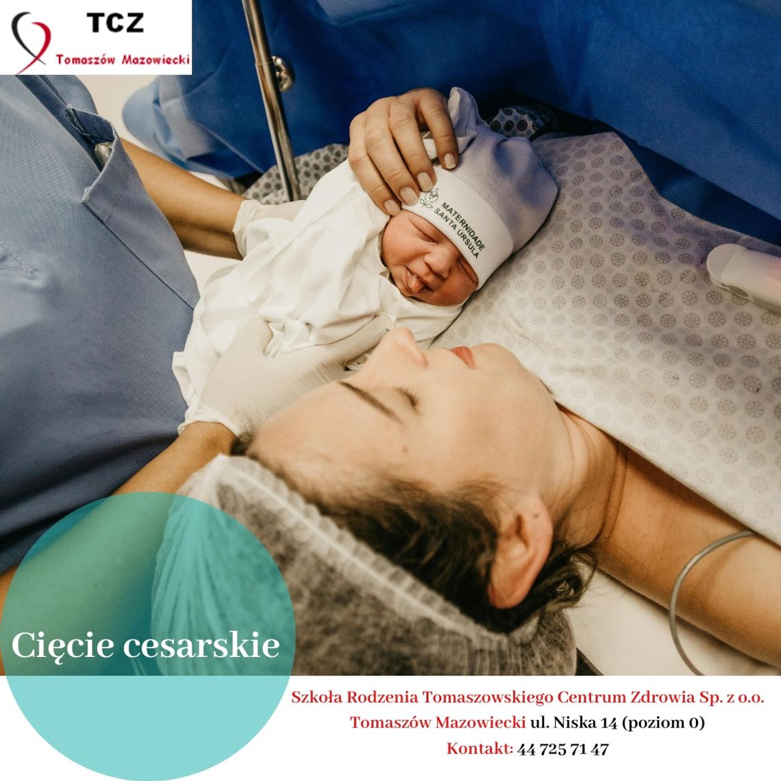 Zapraszamy do szkoły rodzenia TCZ: Cięcie cesarskie - kiedy konieczne? Jak przebiega?